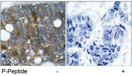 Rabbit Anti HSP27 (Phospho-Ser15) (polyclonal) Immunohistochemical analysis Rabbit Anti HSP27 (Phospho-Ser15) (polyclonal) Immunohistochemical analysis