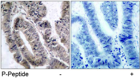 Rabbit Anti AMPK1/AMPK2 (Phospho-Ser485/491) (polyclonal) Immunohistochemical analysis Rabbit Anti AMPK1/AMPK2 (Phospho-Ser485/491) (polyclonal) Immunohistochemical analysis