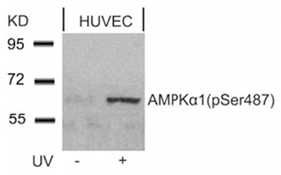 Rabbit Anti AMPK1/AMPK2 (Phospho-Ser485/491) (polyclonal) Western blot analysis Rabbit Anti AMPK1/AMPK2 (Phospho-Ser485/491) (polyclonal) Western blot analysis