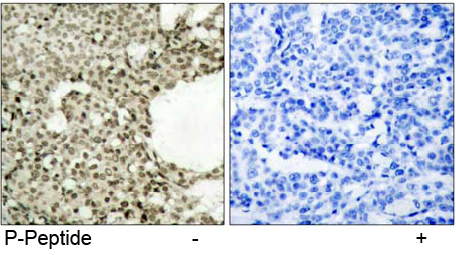 Rabbit Anti STAT1 (Phospho-Ser727) (polyclonal) Immunohistochemical analysis Rabbit Anti STAT1 (Phospho-Ser727) (polyclonal) Immunohistochemical analysis