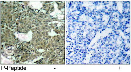 Rabbit Anti MEK1 (Phospho-Ser221) (polyclonal) Immunohistochemical analysis