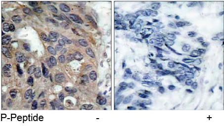 Rabbit Anti Src (Phospho-Tyr529) (polyclonal) Immunohistochemical analysis Rabbit Anti Src (Phospho-Tyr529) (polyclonal) Immunohistochemical analysis