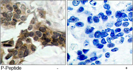 Rabbit Anti IκB-α (Phospho-Ser32, 36) (polyclonal) Immunohistochemical analysis Rabbit Anti IκB-α (Phospho-Ser32, 36) (polyclonal) Immunohistochemical analysis