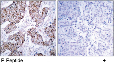 Rabbit Anti EGFR (Phospho-Tyr1092) (polyclonal) Immunohistochemical analysis