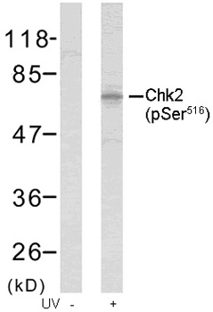 Rabbit Anti Chk2 (Phospho-Ser516) (polyclonal) Western blot analysis Rabbit Anti Chk2 (Phospho-Ser516) (polyclonal) Western blot analysis