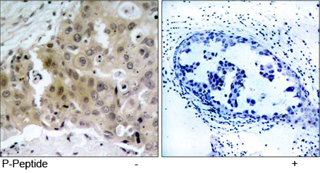 Rabbit Anti VEGFR2 (Phospho-Tyr1175) (polyclonal) Immunohistochemical analysis