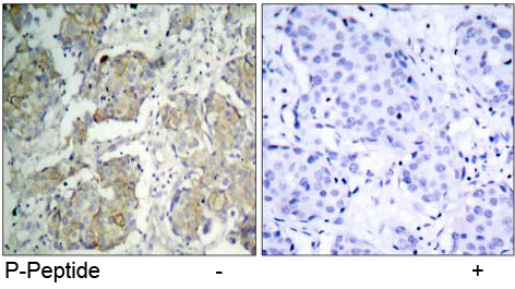 Rabbit Anti VEGFR2 (Phospho-Tyr1214) (polyclonal) Immunohistochemical analysis Rabbit Anti VEGFR2 (Phospho-Tyr1214) (polyclonal) Immunohistochemical analysis