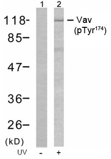 Rabbit Anti Vav (Phospho-Tyr174) (polyclonal) Western blot analysis Rabbit Anti Vav (Phospho-Tyr174) (polyclonal) Western blot analysis