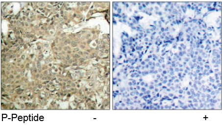 Rabbit Anti cofilin (Phospho-Ser3) (polyclonal) Immunohistochemical analysis
