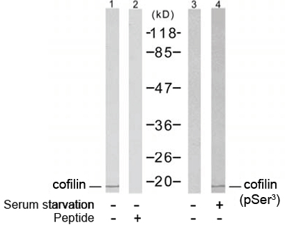Rabbit Anti cofilin (Phospho-Ser3) (polyclonal) Western blot analysis