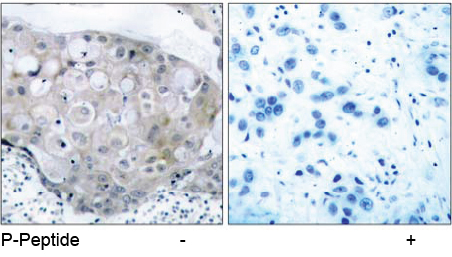 Rabbit Anti-VEGFR2 (Phospho-Tyr951) Polyclonal Antibody IHC Rabbit Anti-VEGFR2 (Phospho-Tyr951) Polyclonal Antibody IHC