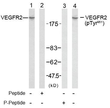 Rabbit Anti-VEGFR2 (Phospho-Tyr951) Polyclonal Antibody WB Rabbit Anti-VEGFR2 (Phospho-Tyr951) Polyclonal Antibody WB