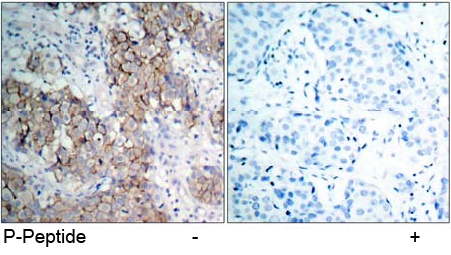 Rabbit Anti IGF-1R (Phospho-Tyr1161) (polyclonal) Immunohistochemical analysis Rabbit Anti IGF-1R (Phospho-Tyr1161) (polyclonal) Immunohistochemical analysis