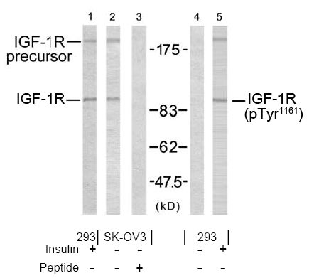 Rabbit Anti IGF-1R (Phospho-Tyr1161) (polyclonal) Western blot analysis Rabbit Anti IGF-1R (Phospho-Tyr1161) (polyclonal) Western blot analysis