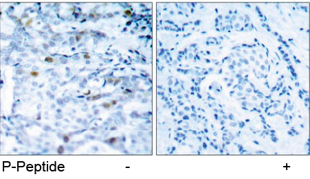 Rabbit Anti CDC2 (Phospho-Thr161) (polyclonal) Immunohistochemical analysis Rabbit Anti CDC2 (Phospho-Thr161) (polyclonal) Immunohistochemical analysis