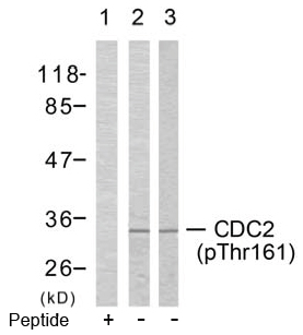 Rabbit Anti CDC2 (Phospho-Thr161) (polyclonal) Western blot analysis Rabbit Anti CDC2 (Phospho-Thr161) (polyclonal) Western blot analysis