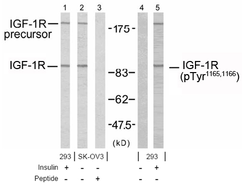 Rabbit Anti IGF-1R (Phospho-Tyr1165, 1166) (polyclonal) Western blot analysis Rabbit Anti IGF-1R (Phospho-Tyr1165, 1166) (polyclonal) Western blot analysis