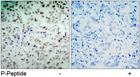 Rabbit Anti Rb(Phospho-Ser780) (polyclonal) Immunohistochemical analysis Rabbit Anti Rb(Phospho-Ser780) (polyclonal) Immunohistochemical analysis