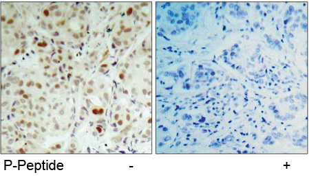 Rabbit Anti Rb (Phospho-Ser807) (polyclonal)Immunohistochemical analysis