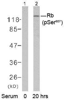 Rabbit Anti Rb (Phospho-Ser807) (polyclonal) Western blot analysis