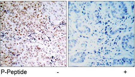 Rabbit Anti Rb (Phospho-Ser795) (polyclonal) Immunohistochemical analysis