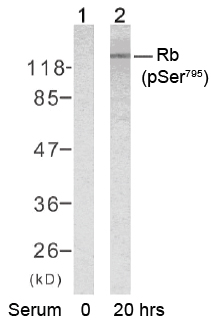 Rabbit Anti Rb (Phospho-Ser795) (polyclonal) Western blot analysis