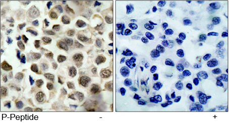 Rabbit Anti HDAC8 (Phospho-Ser39) (polyclonal) Immunohistochemical analysis