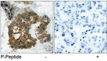 Rabbit Anti Akt2 (Phospho-Ser474) (polyclonal) Immunohistochemical analysis Rabbit Anti Akt2 (Phospho-Ser474) (polyclonal) Immunohistochemical analysis