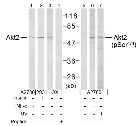 Rabbit Anti Akt2 (Phospho-Ser474) (polyclonal) Western blot analysis Rabbit Anti Akt2 (Phospho-Ser474) (polyclonal) Western blot analysis