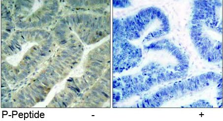 Rabbit Anti Src (Phospho-Tyr418) (polyclonal) Immunohistochemical analysis