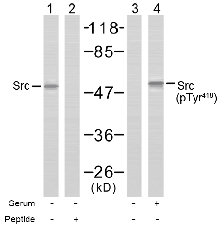 Rabbit Anti Src (Phospho-Tyr418) (polyclonal) Western blot analysis