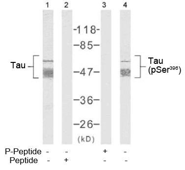 Rabbit Anti Tau (Phospho-Ser396) (polyclonal) Western blot analysis