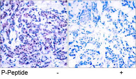 Immunohistochemical analysis using anti JunD (Phospho-Ser<sup>255</sup>)