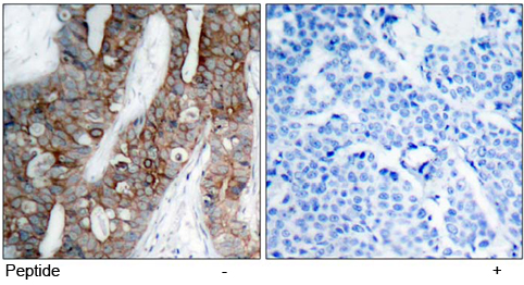Rabbit Anti Integrin β3(Ab-773)(polyclonal) Immunohistochemical analysis