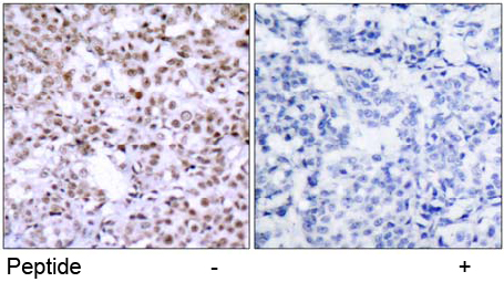Rabbit Anti Chk2(Ab-68)(polyclonal)Immunohistochemical analysis Rabbit Anti Chk2(Ab-68)(polyclonal) Immunohistochemical analysis