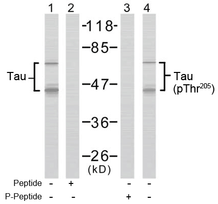 Rabbit Anti  Tau(Ab-205) (polyclonal)Western blot analysis