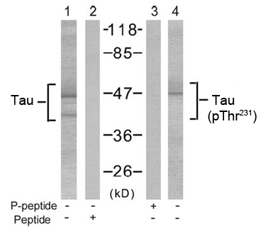 Rabbit Anti Tau(Ab-231) (polyclonal)Western blot analysis