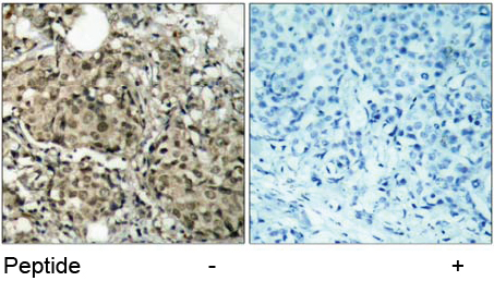 Rabbit Anti G3BP-1(Ab-232)(polyclonal)Immunohistochemical analysis Rabbit Anti G3BP-1(Ab-232)(polyclonal) Immunohistochemical analysis