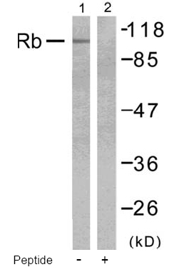 Rabbit Anti Rb(Ab-780) (polyclonal)Western blot analysis