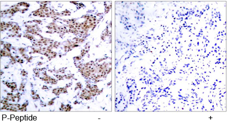 Rabbit Anti MEF2A Phospho-Thr 312 Immunohistochemical analysis using anti MEF2A Phospho-Thr 312