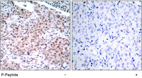 Immunohistochemical analysis using anti Estrogen Receptor-α (Phospho-Ser<sup>104</sup>) 