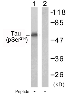 Western blot analysis using anti Tau Phospho-Ser 214