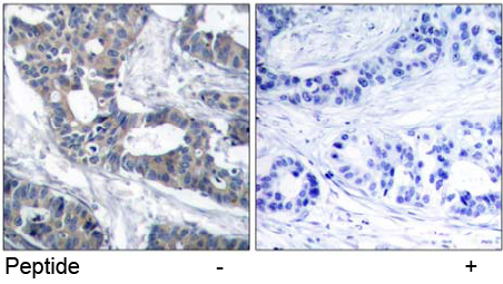 Anti MEK1 Ab-291 Immunohistochemical analysis using anti MEK1 Ab-291