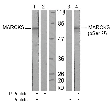 Rabbit Anti-MARCKS (Ab-158) Polyclonal Antibody WB Rabbit Anti-MARCKS (Ab-158) Polyclonal Antibody WB