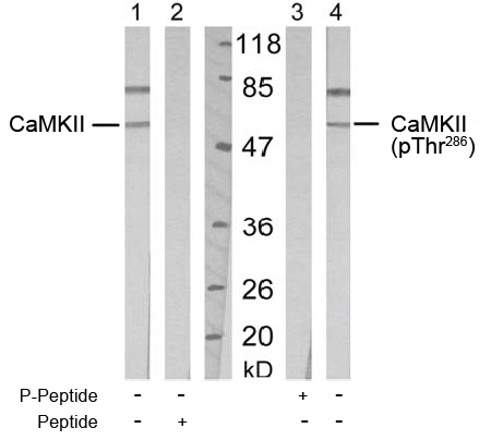 Western blot analysis using anti CaMKII (Ab-286)