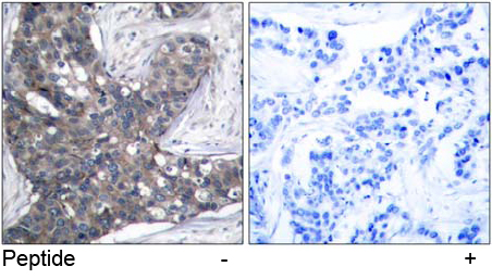 Rabbit Anti-eIF2α (Ab-51) Polyclonal Antibody IHC
