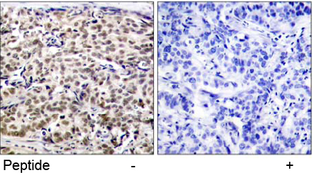 Immunohistochemical analysis using anti CREB (Ab-129)