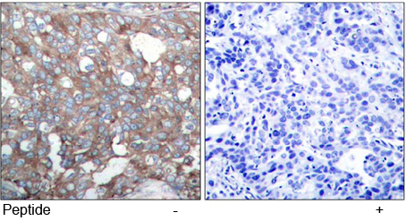 Anti Cortactin (Ab-421) Immunohistochemical analysis using anti Cortactin (Ab-421)