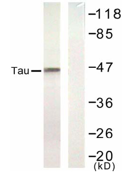 Anti Tau (Ab-422) Western blot analysis using anti Tau (Ab-422)