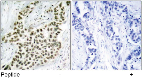 Rabbit Anti-Histone H2A.X (Ab-139) Polyclonal Antibody IHC
